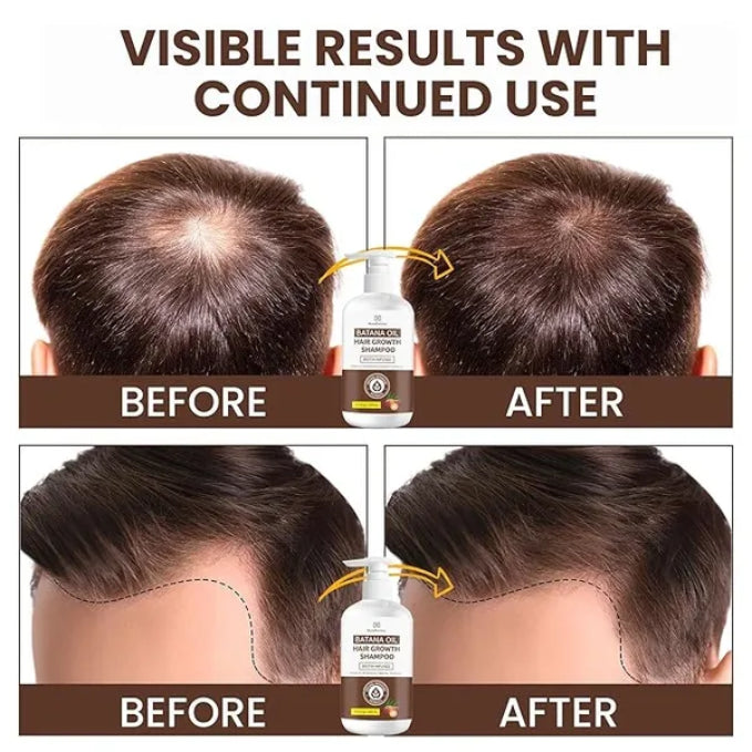 Batana Oil Hair Growth Shampoo: Natural Hair Loss Shampoo for Thinning Hair for Women and Men - Daily Hair Care at Home - 10.1 fl.oz