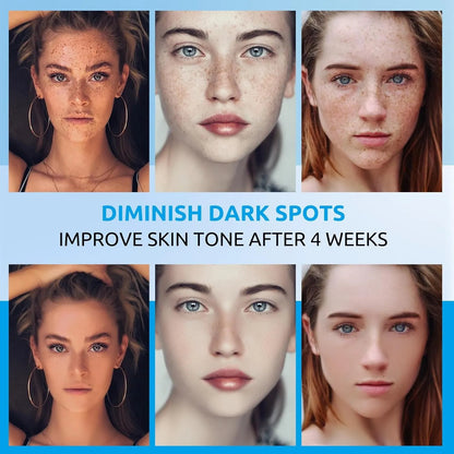 Dark Spot Remover for Face and Body, Dark Spot Corrector Cream, Skin Brown Spot Remover, Skin Care Face Cream, Sun Spot Remover, Rapid Tone Repair Retinol (2 Fl Oz)