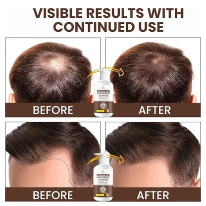 Batana Oil Hair Growth Shampoo: Natural Hair Loss Shampoo for Thinning Hair for Women and Men - Daily Hair Care at Home - 10.1 fl.oz