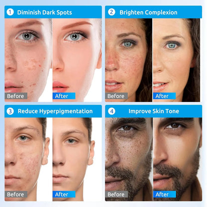 Dark Spot Remover for Face and Body, Dark Spot Corrector Cream, Skin Brown Spot Remover, Skin Care Face Cream, Sun Spot Remover, Rapid Tone Repair Retinol (2 Fl Oz)