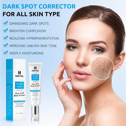 Dark Spot Remover for Face and Body, Dark Spot Corrector Cream, Skin Brown Spot Remover, Skin Care Face Cream, Sun Spot Remover, Rapid Tone Repair Retinol (2 Fl Oz)